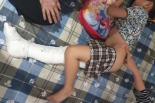 Học sinh gãy chân tại Trường tiểu học Nam Trung Yên bị thương tật 32%