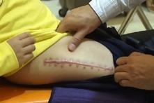 Vụ học sinh tiểu học gãy chân: Cháu bé được đưa đi giám định