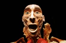 Nguồn gốc thi thể nhựa hóa: Hé mở từ hộp sọ bị đạn xuyên thủng