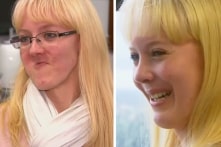 Úc: Lần đầu tiên cấy ghép hàm trên giả bằng công nghệ in 3D