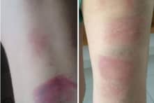 Tạm đình chỉ một tháng đối với cô giáo đánh 22 học sinh