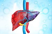 Người gầy cũng bị gan nhiễm mỡ, cách ngăn ngừa căn bệnh này