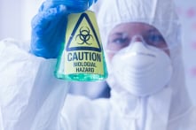 Nghiên cứu: Virus corona mới có thể tấn công hệ miễn dịch giống HIV