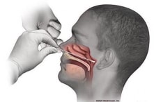 Các chuyên gia lấy mẫu xét nghiệm COVID-19 như thế nào?