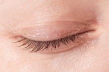 Mí mắt của bạn có màu trong mờ không? Hãy cùng xem hình ảnh này