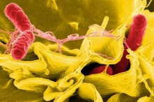 CDC Mỹ: Vi khuẩn Salmonella không rõ nguồn gốc lan rộng ra 29 tiểu bang