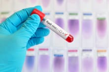 Dịch cúm virus Nipah bùng phát tại Ấn Độ; tỷ lệ tử vong lên đến 75%