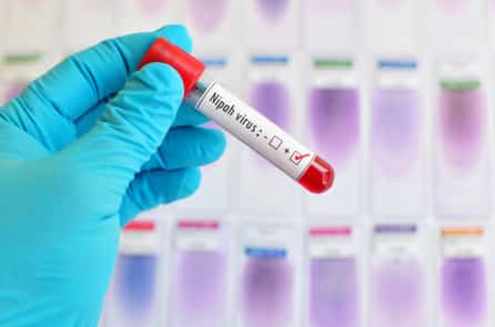 Dịch cúm virus Nipah bùng phát tại Ấn Độ; tỷ lệ tử vong lên đến 75%