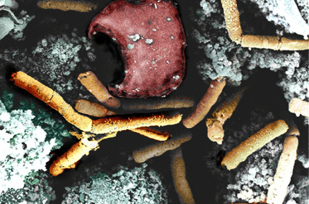 Sự kiện rò rỉ vi khuẩn bệnh than – Lịch sử có lặp lại?