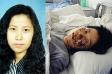 Khuôn mặt Cao Dung Dung và mặt thật của một cuộc bức hại tại TQ