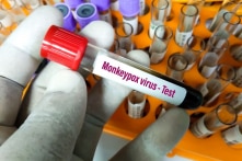 WHO đánh giá các báo cáo virus đậu mùa khỉ có trong tinh dịch của bệnh nhân