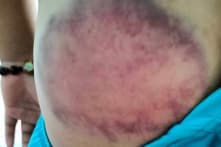 Thầy chủ nhiệm lớp 4 bị yêu cầu thay thế vì đánh bầm tím mông học sinh