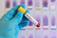 Bệnh Melioidosis (Whitmore) bùng phát ở Hồng Kông, 7 ca tử vong