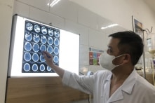 Bắc Ninh: 37 công nhân nhiễm độc methanol, 4 người di chứng nặng, 1 người tử vong