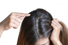 Có nên nhổ tóc bạc hay không? 