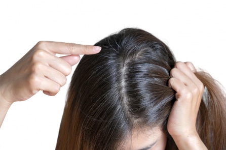 Có nên nhổ tóc bạc hay không? 