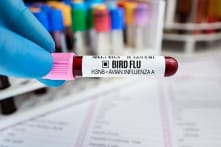 Nghiên cứu: Virus cúm gia cầm H3N8 ở người lây nhiễm cao, có thể có nguy cơ bùng phát