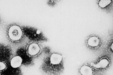 WHO xác định biến chủng JN.1 của virus corona là “hiện tượng cần chú ý”