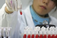 Dịch AIDS ở Trung Quốc đáng sợ hơn những gì được công bố