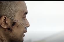 Bệnh nhân COVID-19 đầu tiên ở Vũ Hán được tiết lộ, má bị loét, sống không bằng chết