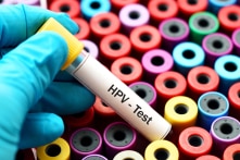 Hơn 800 triệu người Trung Quốc, gần 60% dân số, nhiễm bệnh phụ khoa HPV?