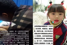 TQ: Người mẹ tố bệnh viện lừa “khám sức khỏe”, mổ cắp thận của con gái 8 tuổi