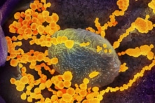 Nghiên cứu mới xác định cơ chế chính gây bệnh COVID-19