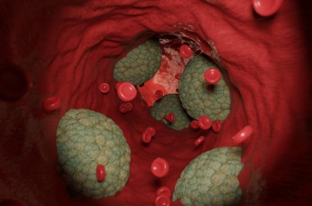4 cách hạ mỡ máu không dùng thuốc statin