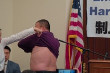 Nạn nhân sống sót sau khi bị thu hoạch nội tạng tiếp tục tố cáo ĐCSTQ