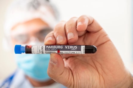 Sở Y tế TP.HCM: Nguy cơ bệnh Marburg xâm nhập không cao, nhưng vẫn có thể
