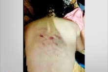 Thanh  Hóa: Cô giáo véo tai, đánh học sinh lớp 1 bầm tím lưng