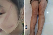 Vụ nhiều trẻ mầm non bị bạn đánh ở Nghệ An: Cô giáo trông hộ bị tạm đình chỉ