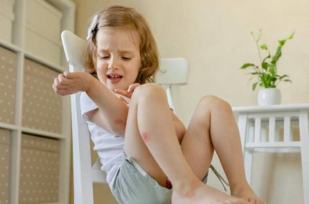 Mẹo dân gian chữa vết bỏng, vết thương và vết côn trùng cắn