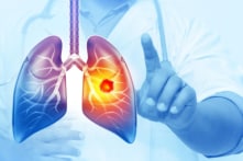 2 thói quen giúp tỷ phú Đài Loan sống khỏe mạnh 20 năm sau ung thư