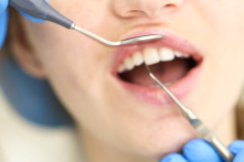 Răng giả hay cấy ghép: Loại nào phù hợp với bạn?