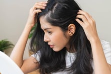 Tóc bạc có thể đen lại? Bí quyết giúp trẻ hóa từ trong ra ngoài