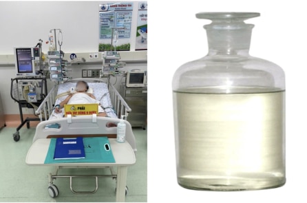 Hít phải khí cực độc trong hóa chất hàn nhựa, bé trai rơi vào hôn mê