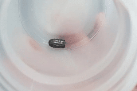 Đang làm vườn, một phụ nữ tại Cần Thơ bị đạn bay găm vào đầu