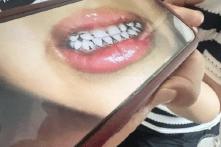 TQ: 70 trẻ mẫu giáo bị ngộ độc chì tập thể, nồng độ cao nhất vượt 500 µg/lít