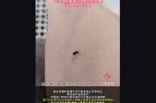 Dịch sốt Chikungunya bùng phát ở Quảng Đông, hơn 4.000 ca trong chưa đầy 10 ngày