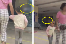 TQ: Bé gái 3 tuổi bị cắm dao vào đầu, vẫn bình tĩnh đi bộ đến bệnh viện