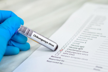 FDA đình chỉ việc cấp phép vắc-xin Chikungunya