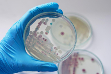 Mỹ: Massachusetts đưa ra cảnh báo về ‘vi khuẩn ăn thịt người’ Vibrio vulnificus