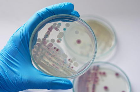 Mỹ: Massachusetts đưa ra cảnh báo về ‘vi khuẩn ăn thịt người’ Vibrio vulnificus