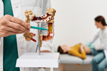 Đồ uống có đường thúc đẩy di căn ung thư đại trực tràng 