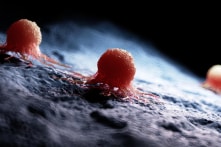 Nghiên cứu: Vô hiệu hóa “lớp khiên đường” của tế bào ung thư