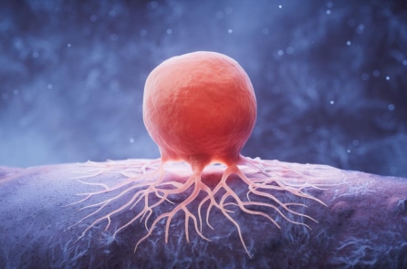 40% ca ung thư trên toàn cầu có thể phòng ngừa