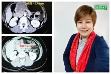 Nhờ thay đổi tâm thái, bệnh nhân ung thư giai đoạn cuối 15 năm không tái phát