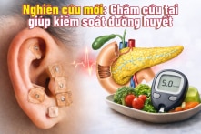 Nghiên cứu mới: Châm cứu tai giúp kiểm soát đường huyết