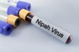 virus nipah bung phat o an do tp hcm ra thong bao moi